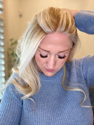 view of natural hairline 